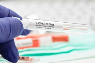 Coronavirus, da domani test rapidi nelle scuole