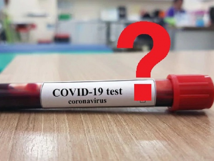 Coronavirus e test sierologici Covid-19: le precisazioni di Avis ai donatori di sangue