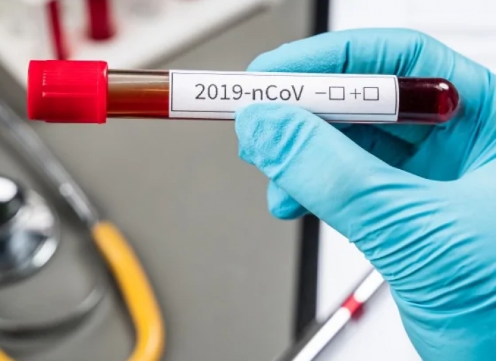 Coronavirus, nel Nord - Ovest della Toscana sono 85 i nuovi contagi