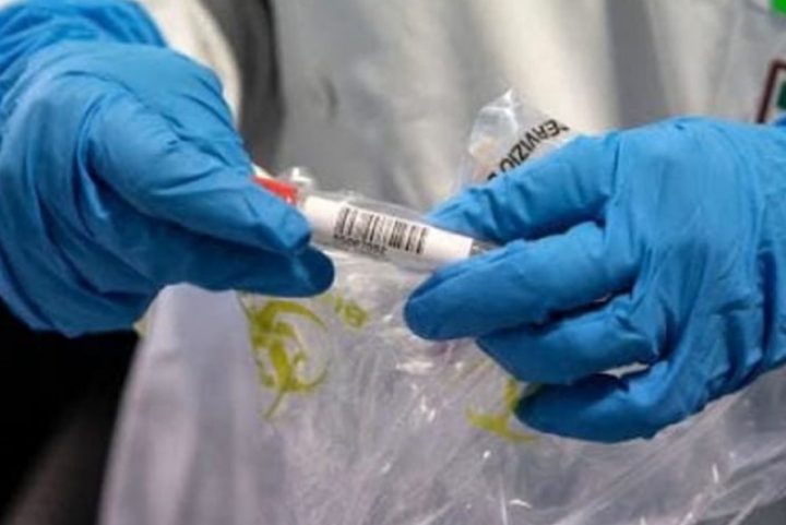 Coronavirus: in Liguria 87 nuovi positivi, calano gli ospedalizzati